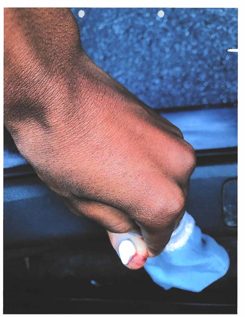 Photographic exhibit page 156. The photograph is investigative material, not independent proof of the alleged cause or conduct.