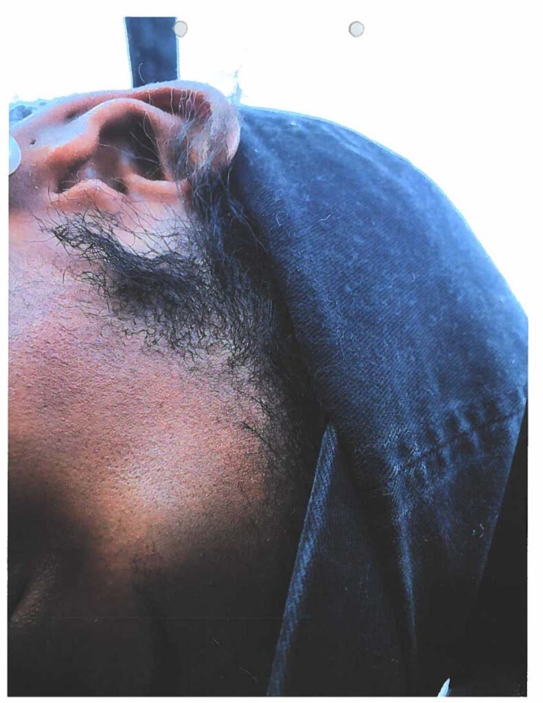 Photographic exhibit page 159. The photograph is investigative material, not independent proof of the alleged cause or conduct.