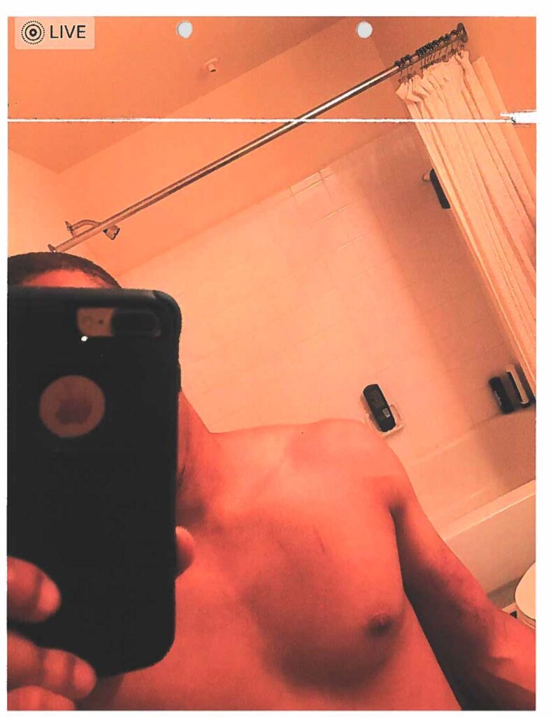 Photographic exhibit page 161. The photograph is investigative material, not independent proof of the alleged cause or conduct.